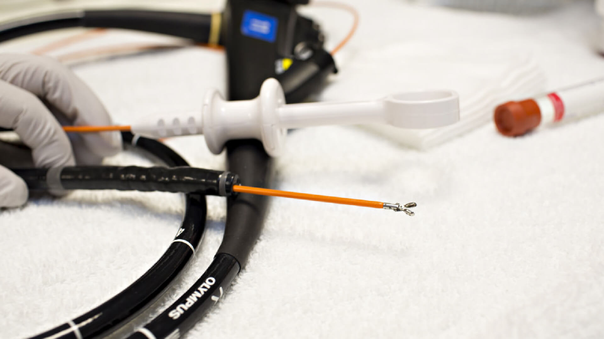 endoscopia